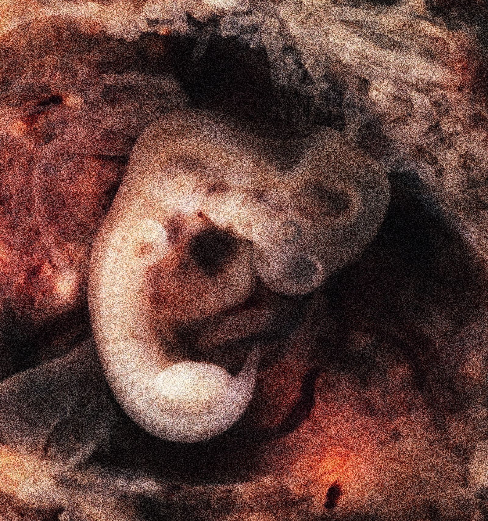 Embrión de cinco semanas