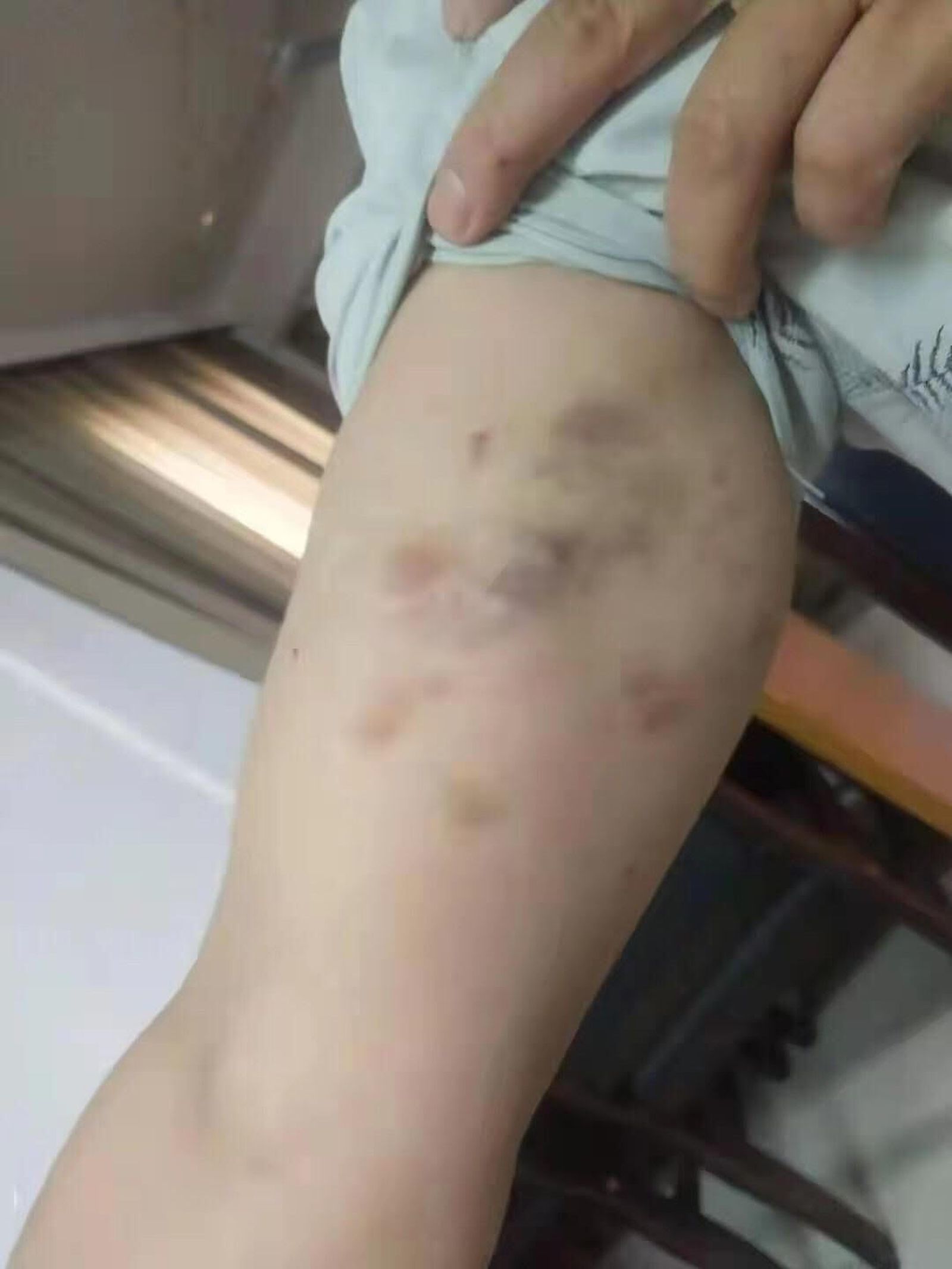 Heridas contra un sacerdote chino