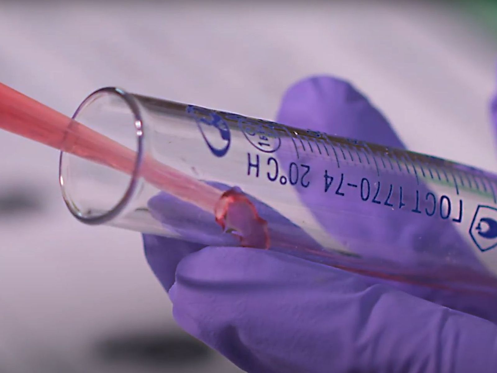 La investigación abre la puerta a diseñar nuevos sistemas de diagnóstico precoz.