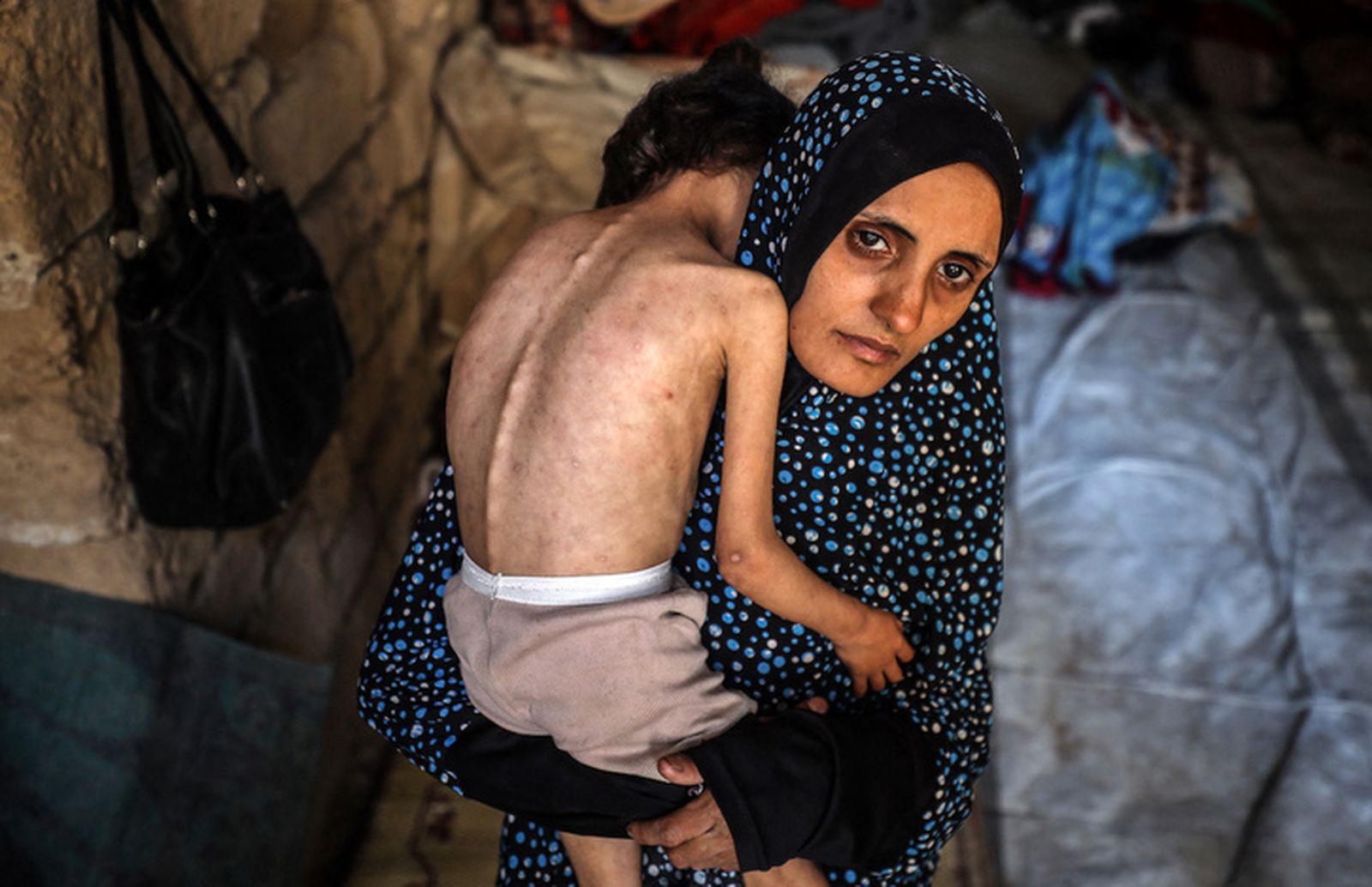 Me duele el telediario